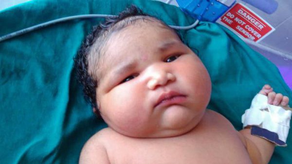Женщина из Индии родила самого большого ребенка за всю историю - фото