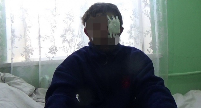 "Свої залишили помирати": СБУ затримала бойовика, який атакував ЗСУ під Авдіївкою (ВІДЕО)