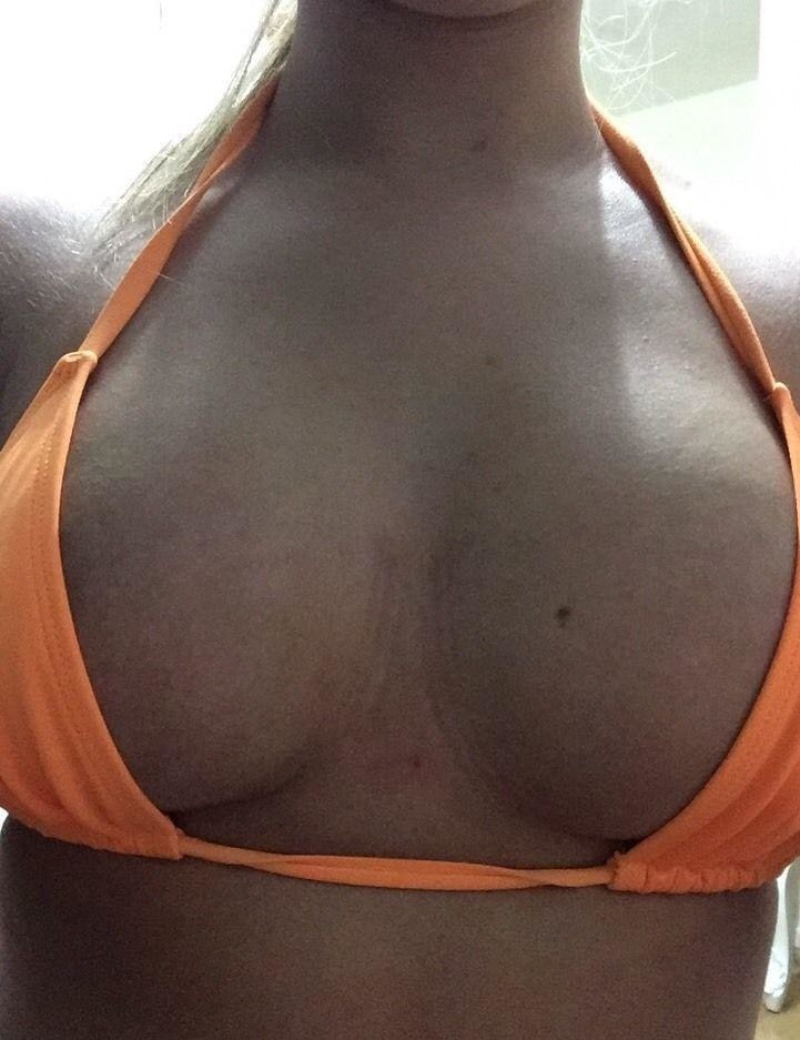 Девушка продаёт на eBay грудные импланты, которые ещё внутри неё