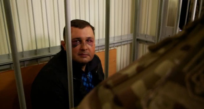 «У меня сломана челюсть, мне трудно говорить»: экс-депутата Шепелева доставили в суд с синяками на лице