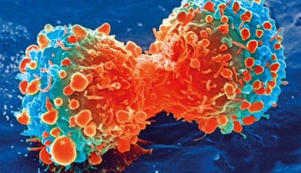 Ученым удалось совершить прорыв в лечении смертельных форм рака