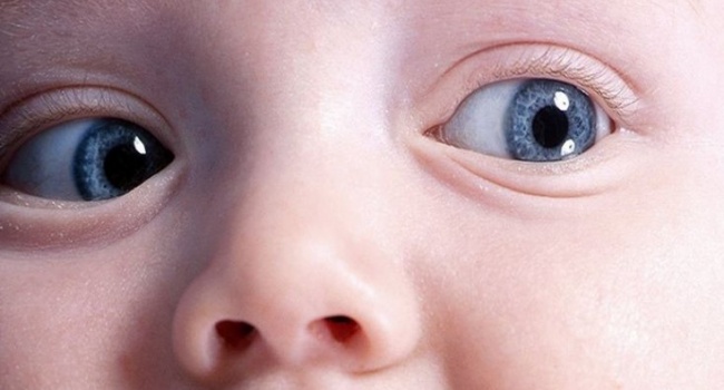 Рекомендація для батьків: Як визначити проблеми зору у немовляти 