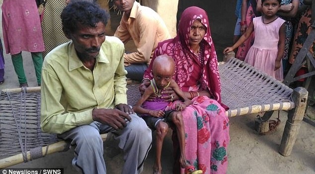 Страшная болезнь: в сети появились фото индийского «Бенджамина Баттона»
