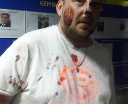 Жесткая драка в Киеве: экс-беркутовцы избили участников АТО