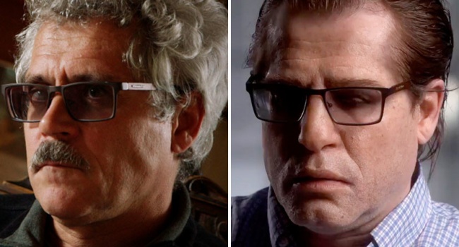 Пластический хирург рассказал о новой внешности Родченкова