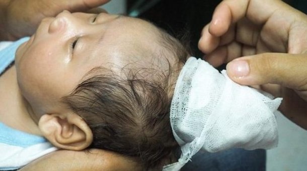 На Филиппинах родился ребенок с жуткой аномалией, - фото