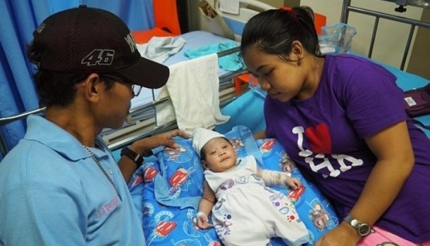 На Филиппинах родился ребенок с жуткой аномалией, - фото