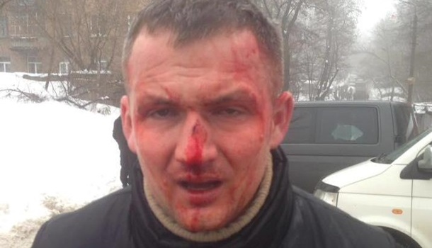 До потери сознания: в Киеве избили народного депутата