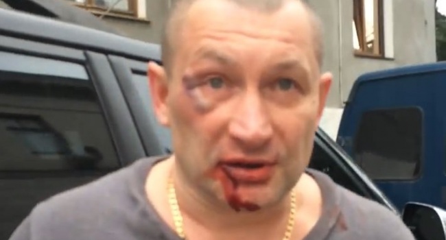 Из-за украинской символики в Крыму жестко избили патриота, обозвав его «укропом и ф*шистом»