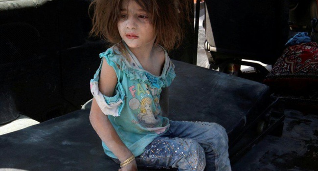 В сети разоблачили жуткий обман с сирийской девочкой, «спасенной» три раза, - постановочные фото