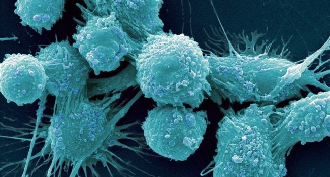 Ученые озвучили самую неожиданную причину развития рака