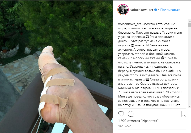 «Главное не шпагатом на ежей»: Волочкова травмировала ногу во время отдыха и получила порцию гневных комментариев от своих подписчиков