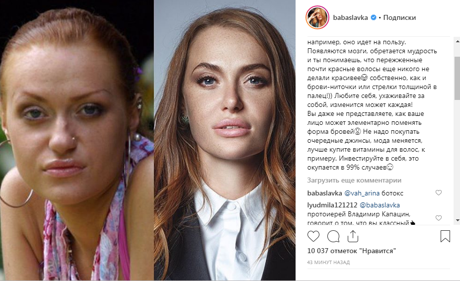 Два разных человека: Слава Каминская показала свое лицо до пластической операции 