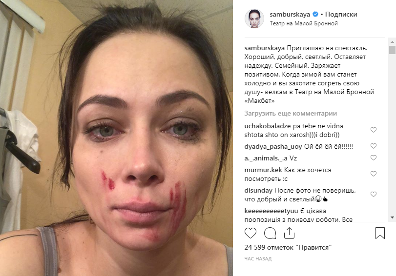 «В слезах и крови»: звезда сериала «Универ» шокировала побитым лицом «В слезах и крови»: звезда сериала «Универ» шокировала побитым лицом