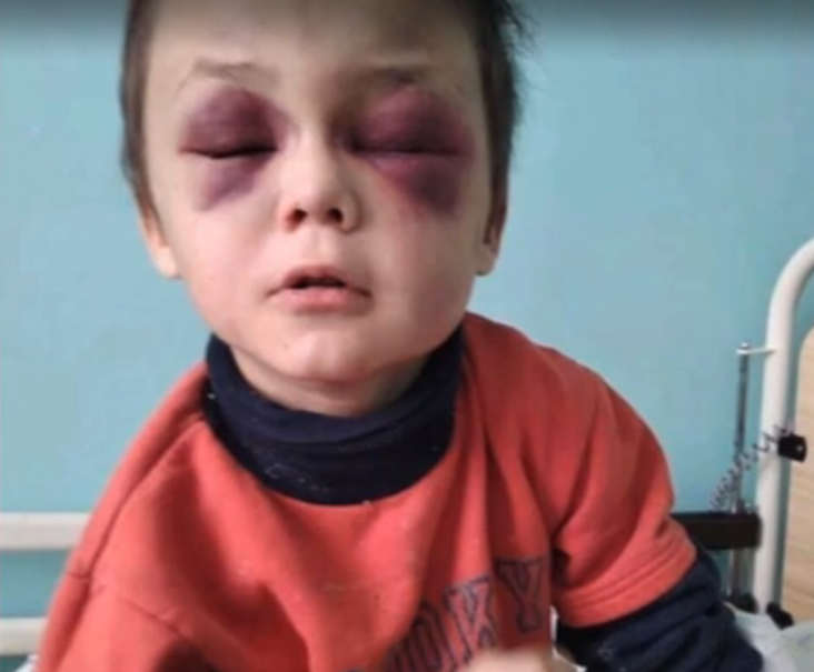 Избиение ребенка на Винниччине: родители объяснили произошедшее