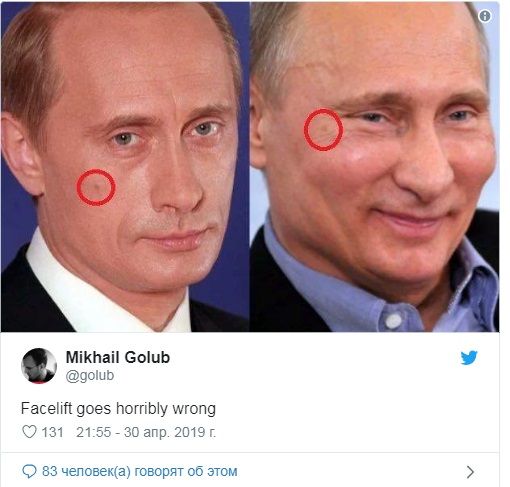 «Глаз на ж*пу — уже реальность»: в сети опубликовали доказательство того, что Путин делал пластическую операцию