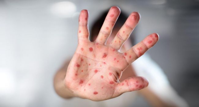  ��������� �������� �������� ���������� �������������� ����� 