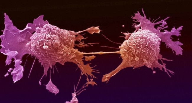 «Троянский конь»: ученые заявили о создании бактерий для борьбы с раком