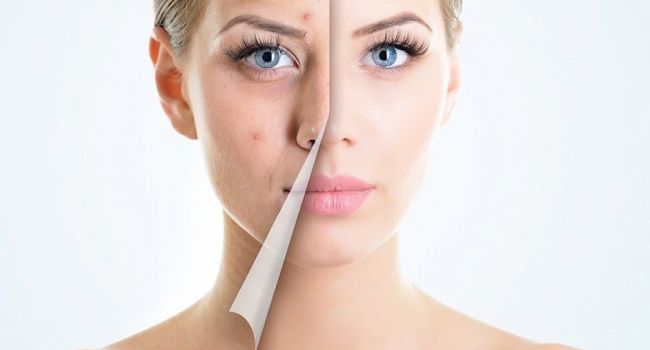 Сыпь на лице может много рассказать о состоянии вашего здоровья