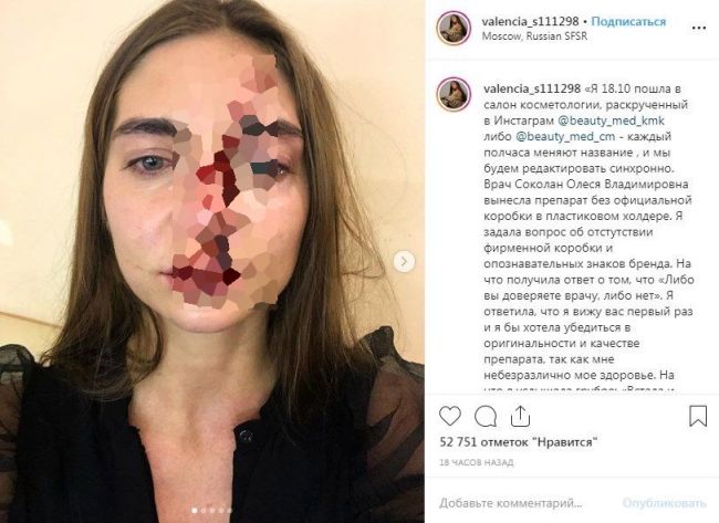 «Встала и пошла вон отсюда!» Российскую певицу избили до крови у косметолога