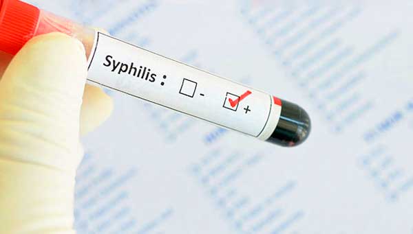 «Соблюдайте основные гигиенические правила»: Сифилис может нанести летальный исход