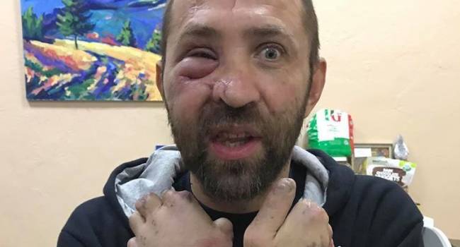 Боец – волонтеру: «Сфоткай меня вот так и покажи им, как нет войны и раненых» Боец – волонтеру: «Сфоткай меня вот так и покажи им, как нет войны и раненых»
