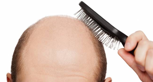 «Как сохранить волосы?»: Британские доктора утверждают, что состояние волос связано с питанием