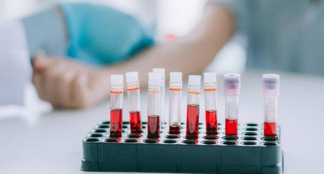 «Это очень важный показатель»: Ученые установили, что низкий уровень лимфоцитов в крови может быть предвестником заболевания с летальным исходом