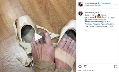 "Было не легко, но все выдержали": Анастасия Волочкова показала искалеченные ноги