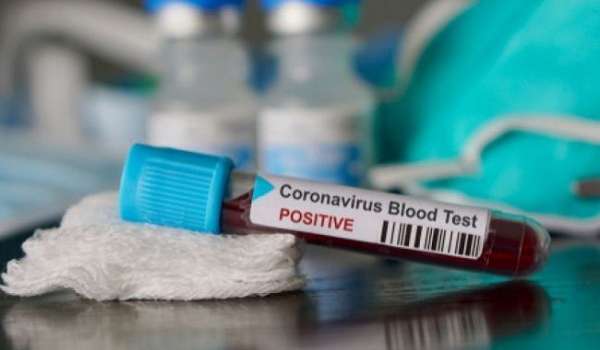 В Беларуси стремительно растет количество заразившихся коронавирусом 