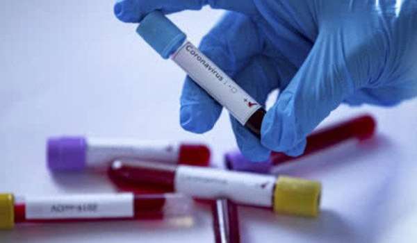 В Винницкой области с подозрением на коронавирус госпитализированы 4 человека