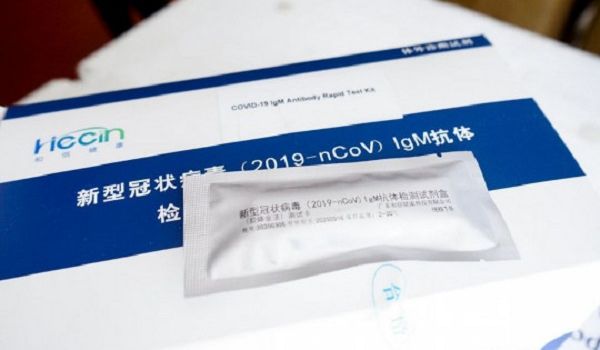 Скандал в Житомире: доставленные из Китая маски решили передать не в больницы, а полицейским 