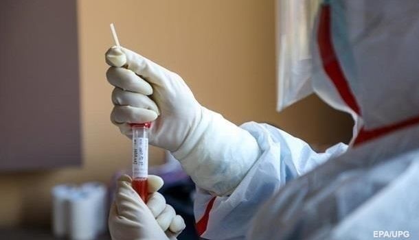 Пять случаев коронавируса зафиксировали в Сумской области 