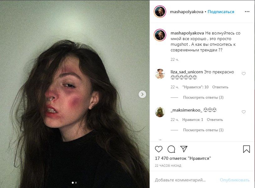 «С мозгами все плохо»: дочь Оли Поляковой опубликовала фото своего избитого лица, напугав пользователей сети 