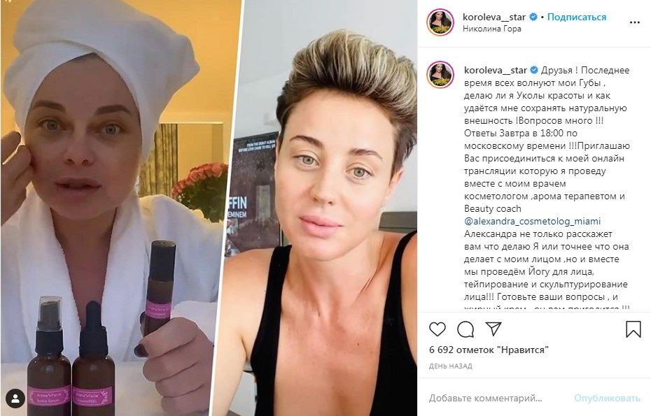Наташа Королева рассказала об уколах красоты и показала свое настоящее лицо без косметики и фильтров 