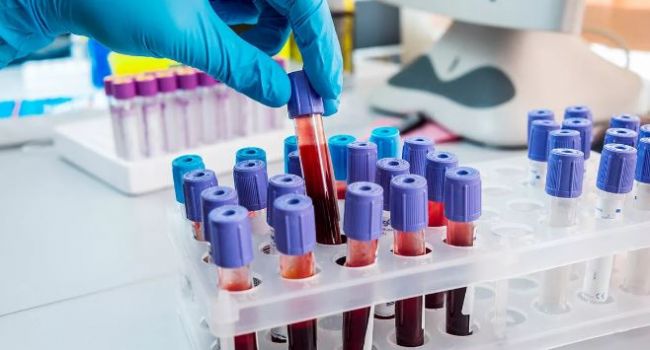 С помощью нового анализа крови можно обнаружить около 50 видов раковых опухолей, - ученые 
