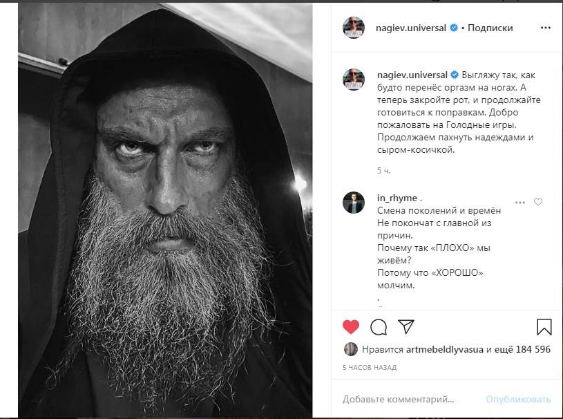 «Перенес оргазм на ногах»: Дмитрий Нагиев ужаснул сеть своим внешним видом 