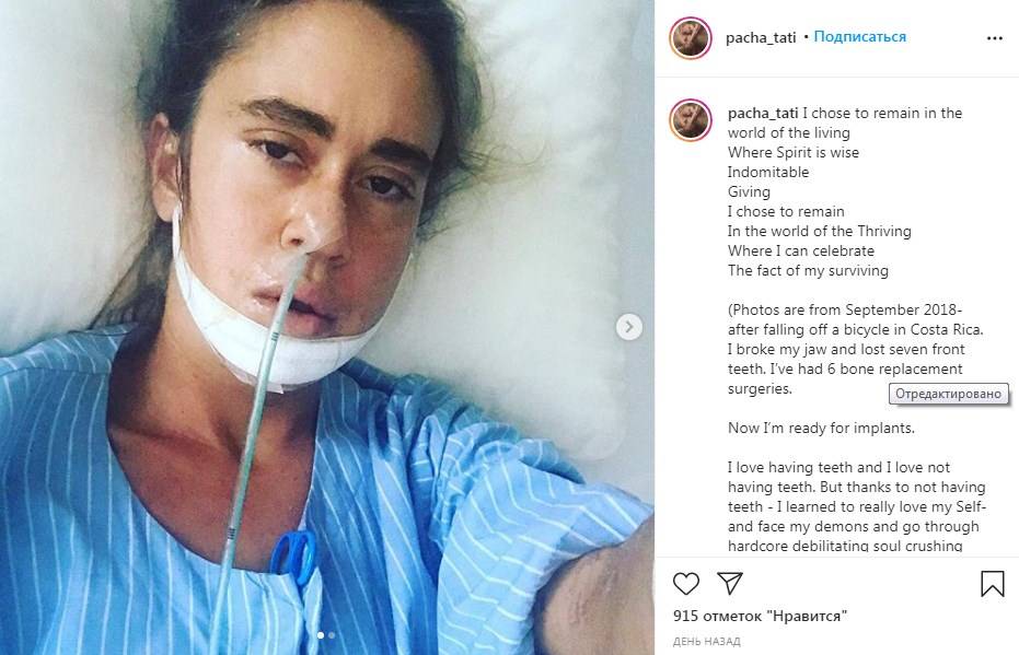 «Я сломала челюсть и потеряла семь передних зубов»: дочь Успенской показала фото с больничной койки 