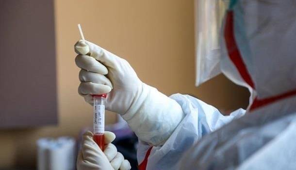 Украина в мировом рейтинге тестирования на коронавирус заняла аж 113 место