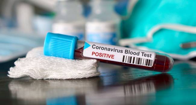«Как минимум - 70 процентов»: Врач предупредил, что коронавирусом переболеют многие украинцы