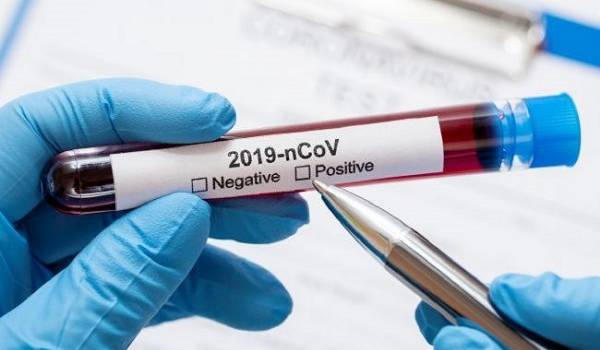 В первом городе Австрии началось массовое тестирование на коронавирус 