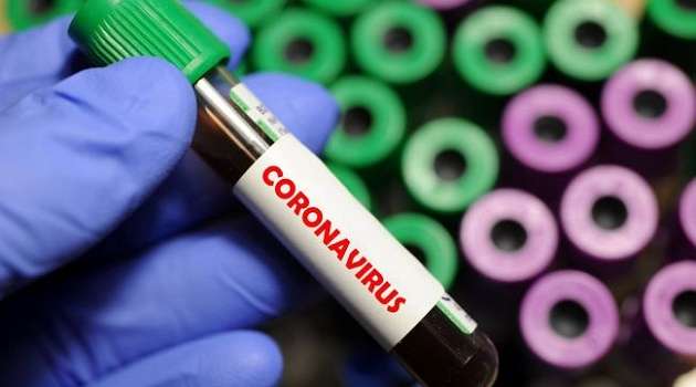 Один из разработчиков «Новичка» готовится разработать лекарство от коронавируса 