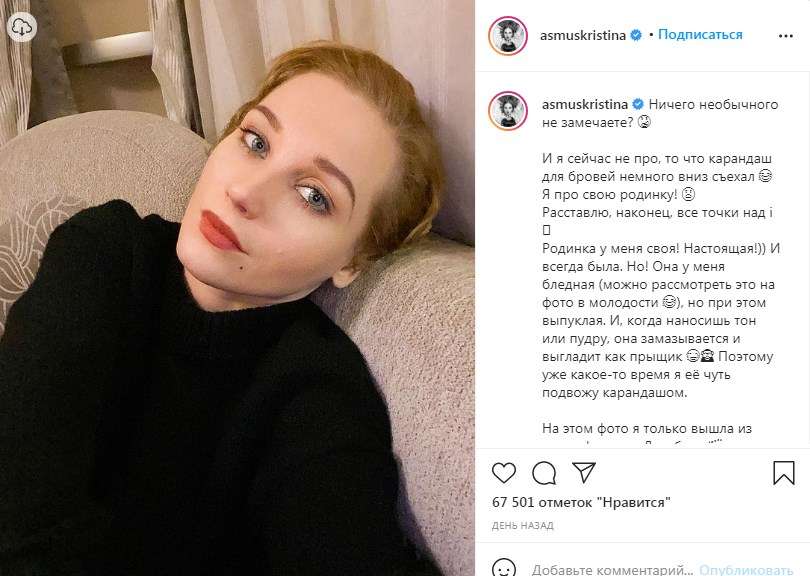 «Какой-то посыл смешной, как будто достижение какое-то или что-то неведомое, нереальное»: Кристина Асмус написала пост о своей родинке, и поддалась критике 