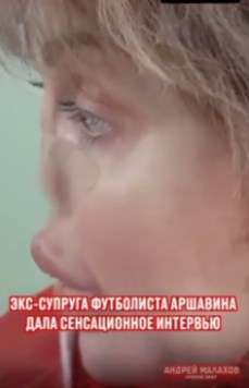 Экс-супруга российского футболиста Андрея Аршавина впервые показала свое лицо с прогнившим носом 