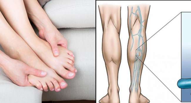 Почему при долгом сидении немеют ноги: интересные медицинские факты